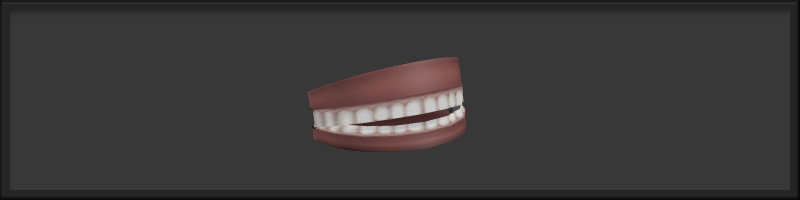Denture